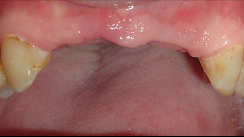 Clinical Study Case 2-1