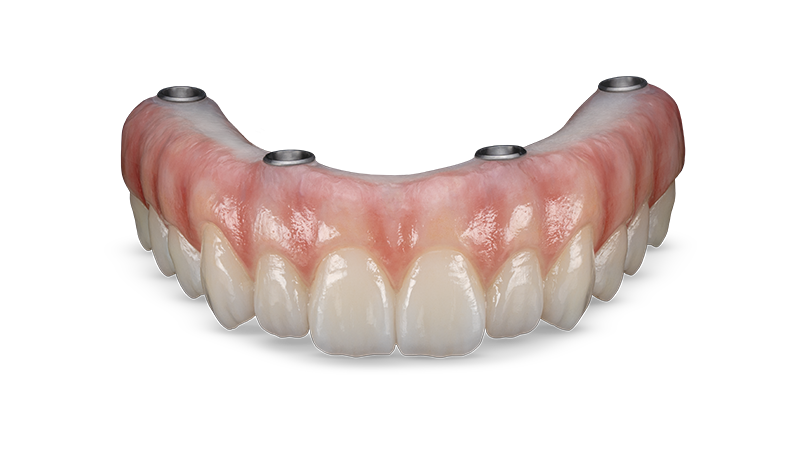 BruxZir® Esthetic Implant Prosthesis
