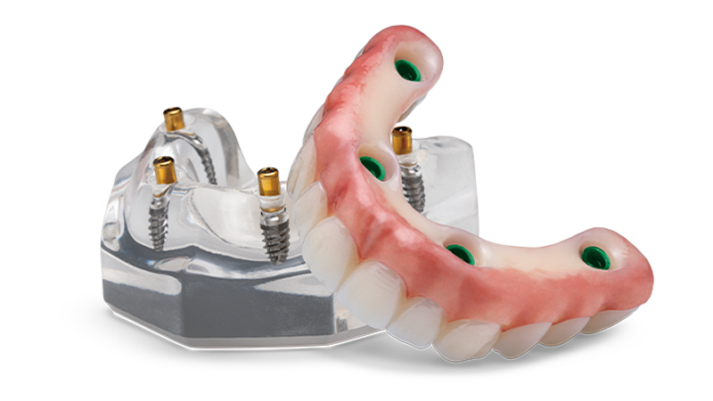 locator-fixed-prosthesis