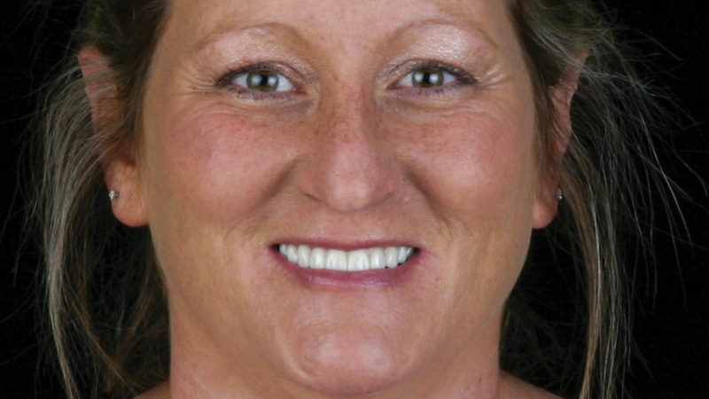 Patient with perfect smile