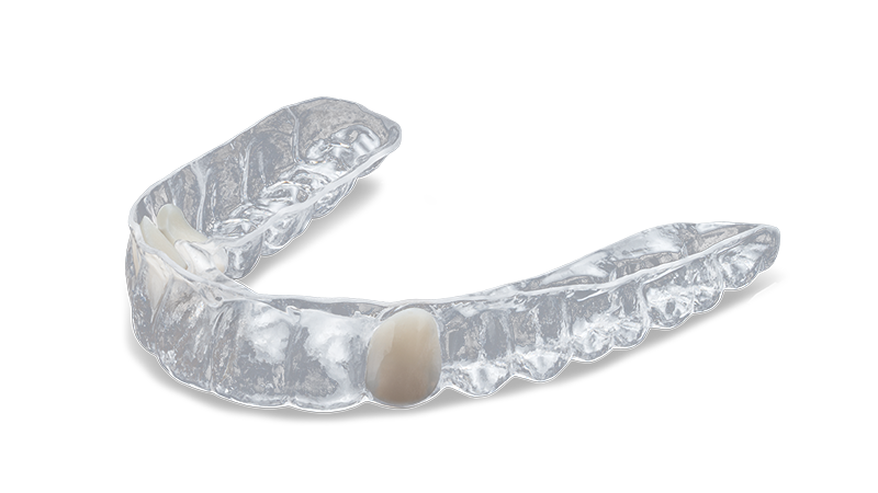 Essix® Retainer
