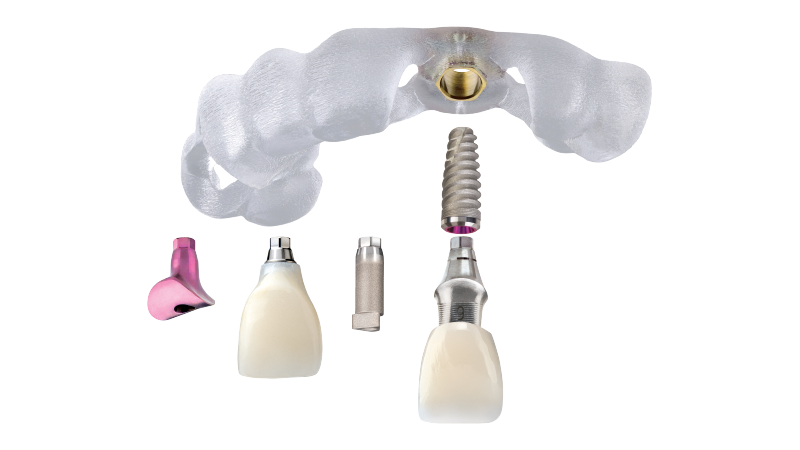 Glidewell™ Tooth Replacement Solution