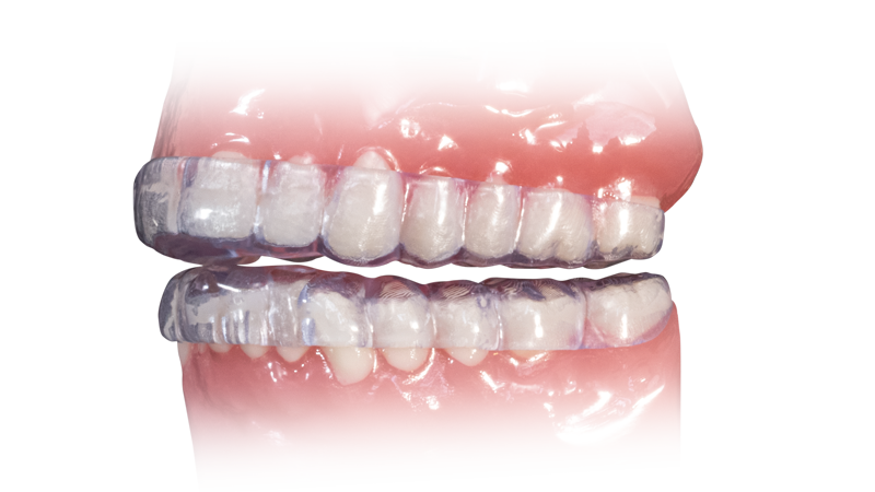 NTI OmniSplint Product Page Signature Image