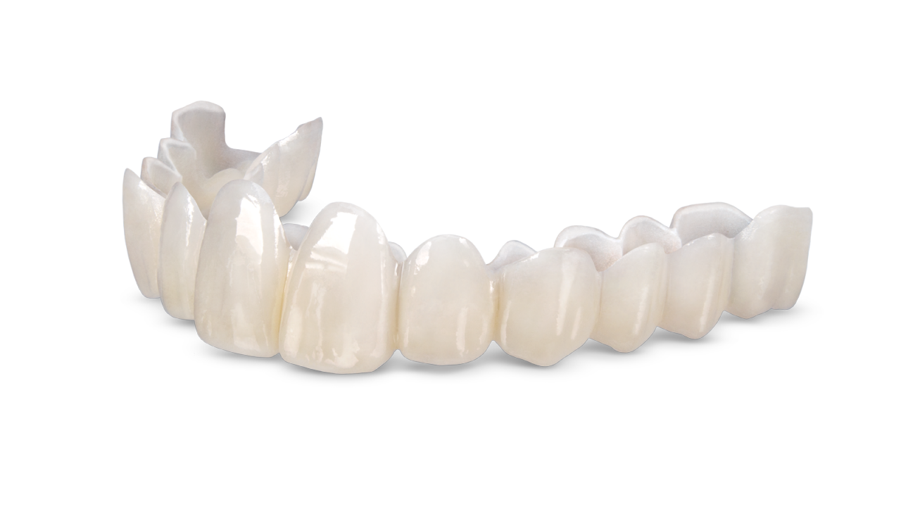 Smile Transitions™