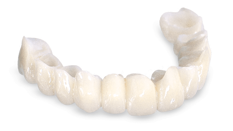 Transition Crowns Bridges Signature Images