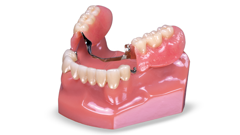 Combination Crowns & Partials Signature Image