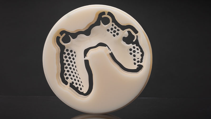 A Milled CAD/CAM-Designed Acetal Partial