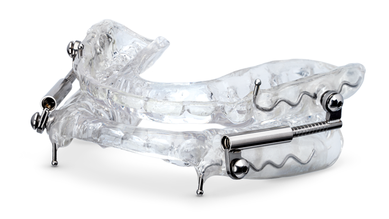 OASYS Hinge Appliance™ Signature Image